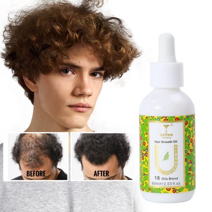 Hair Growth Oil - Image 12