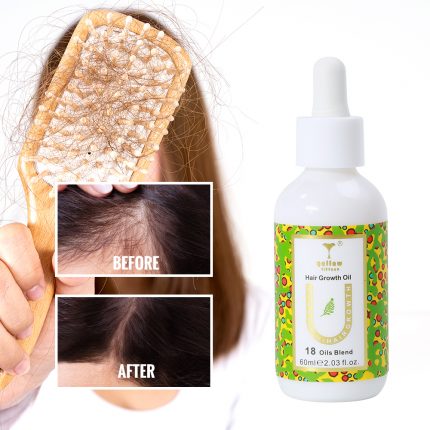 Hair Growth Oil - Image 9