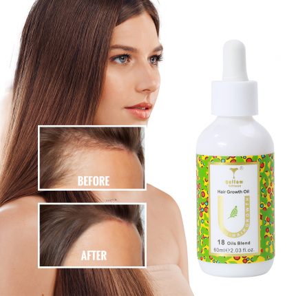 Hair Growth Oil - Image 10